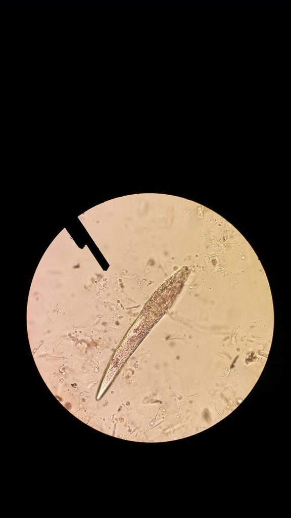 男性のニキビ跡に対するダーマペンの効果はどのくらい？