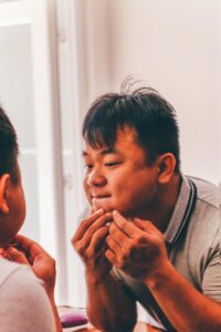 大人ニキビのケア方法はこれで決まり？