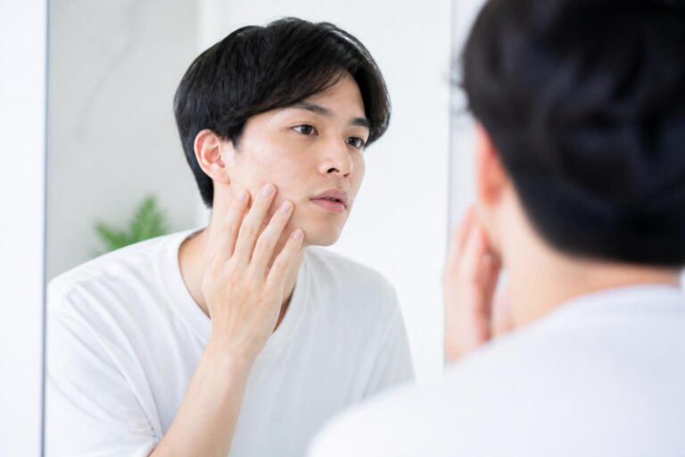 大人男子のニキビ跡を治療する方法はこれだ！？