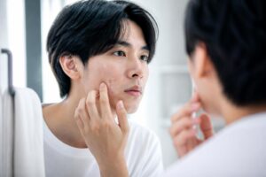 男性のニキビ跡用化粧品はどう選ぶ？