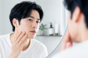 男性のニキビ跡ケアで注意すべき点は？