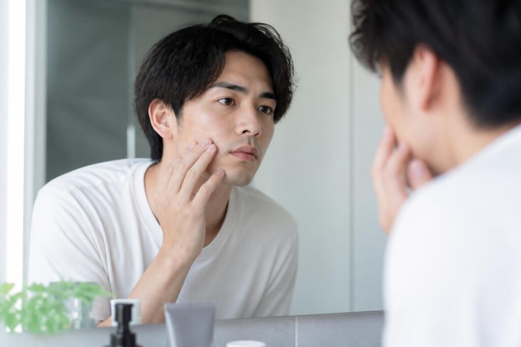 男性用のニキビ跡クリームに効果はある？